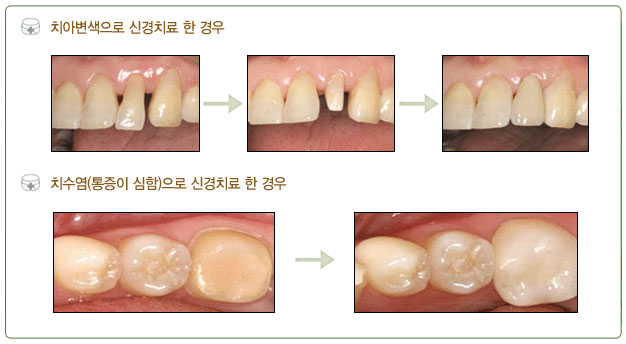 세렉크라운