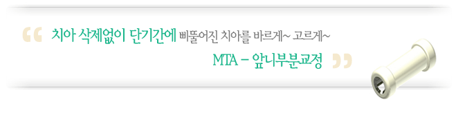 치아 삭제없이 단기간에 삐뚤어진 치아를 바르게 고르게, MTA-앞니 부분교정